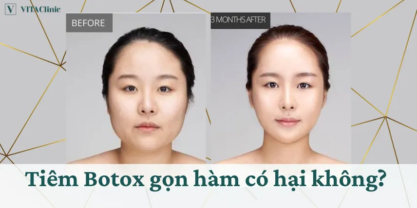 Hiệu quả nhanh chóng