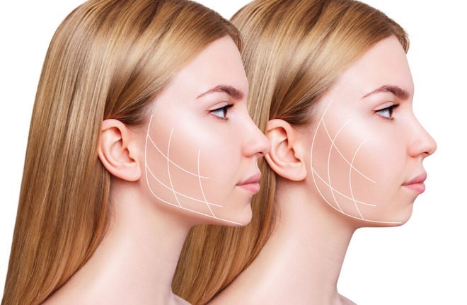Kết quả tự nhiên, mềm mại