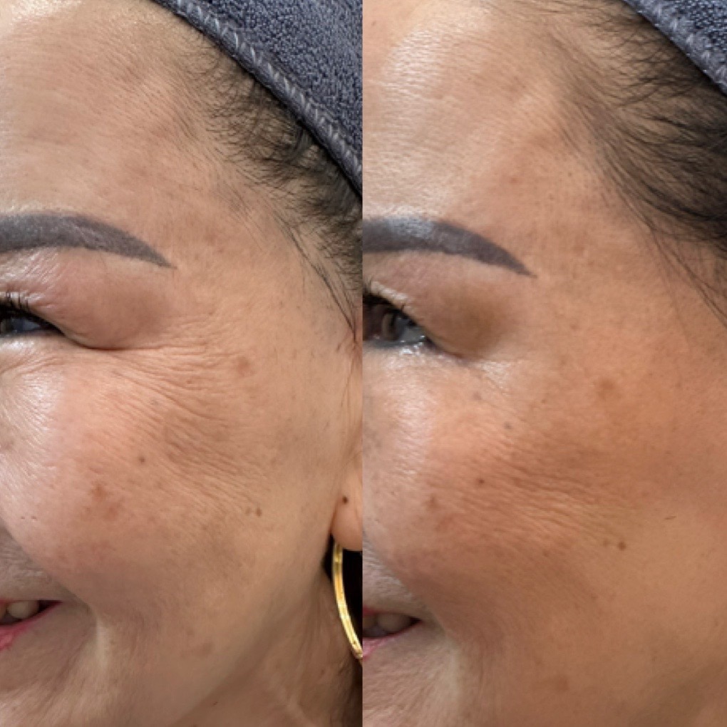 Natural results