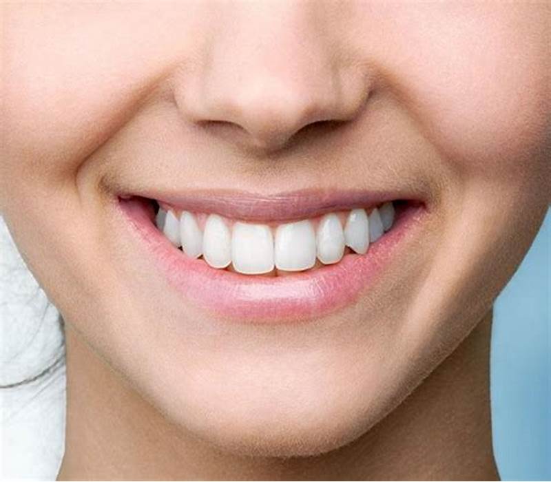 Tiêm rãnh cười là gì?