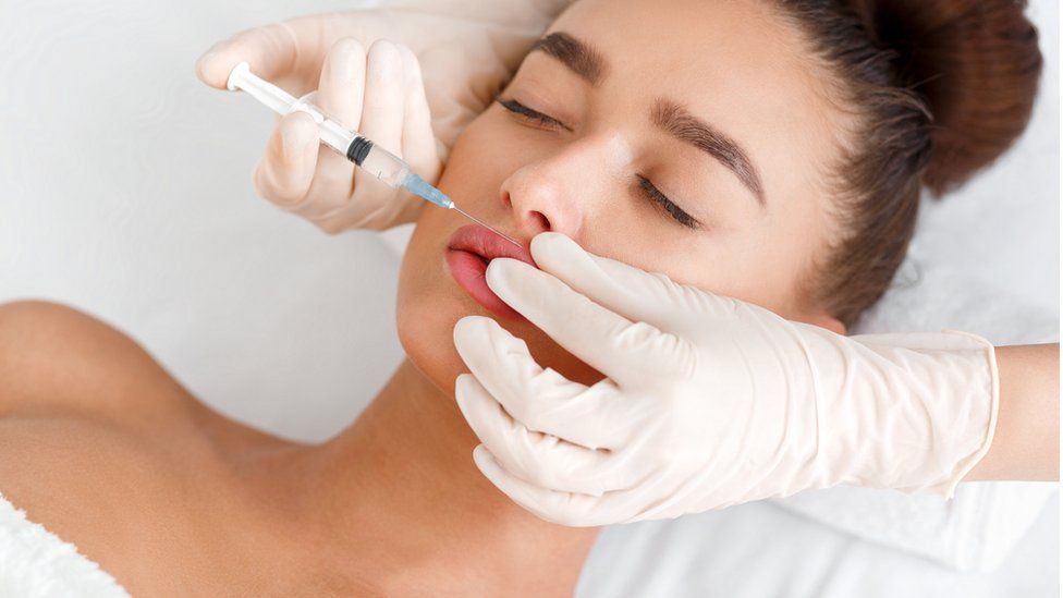 Ưu điểm xóa nhăn môi bằng botox