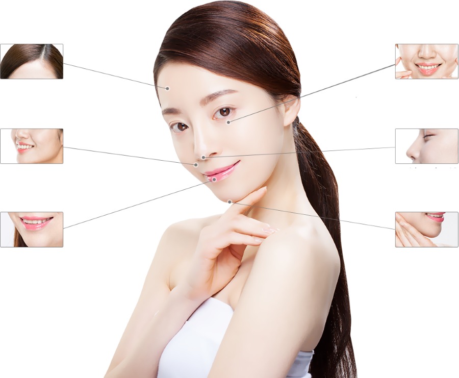 Các vị trí tiêm filler trên mặt