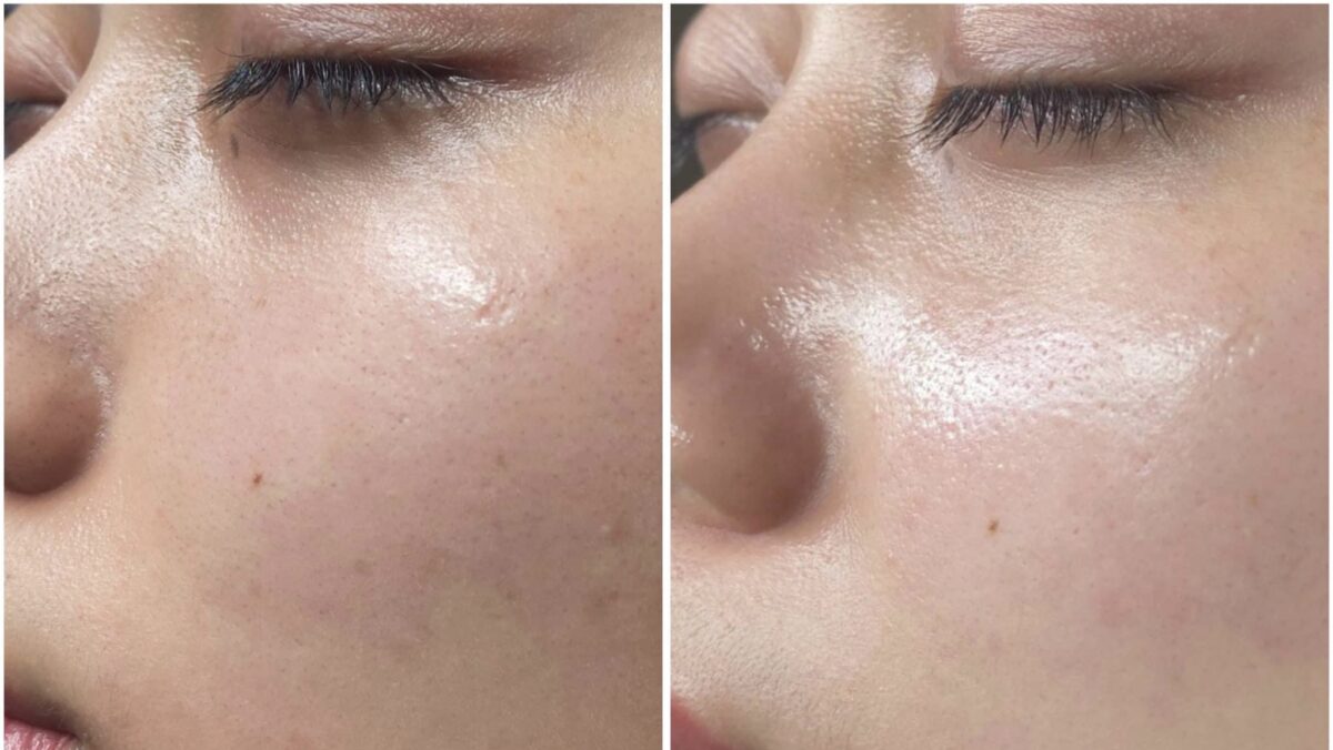 Chăm sóc da Hydra Glow làm sạch sâu, không gây tổn thương