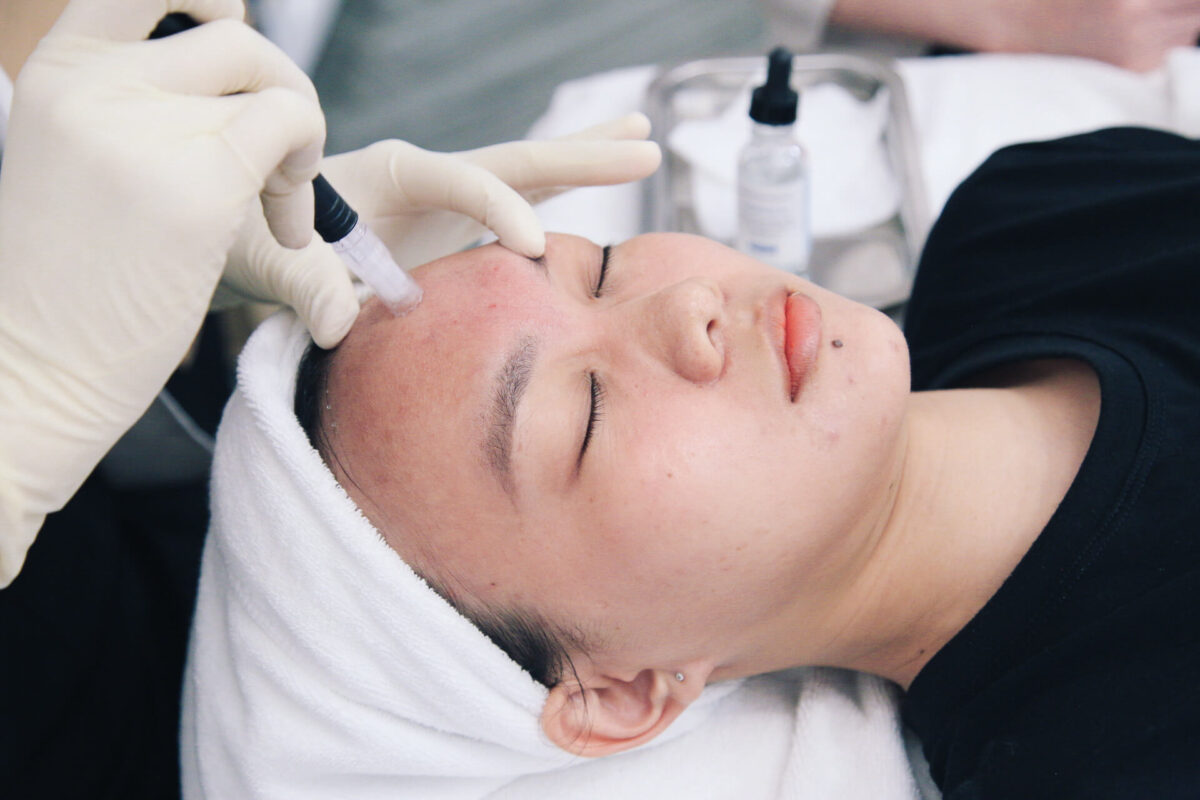 Điều trị da mụn bằng phương pháp lấy mụn chuẩn y khoa
