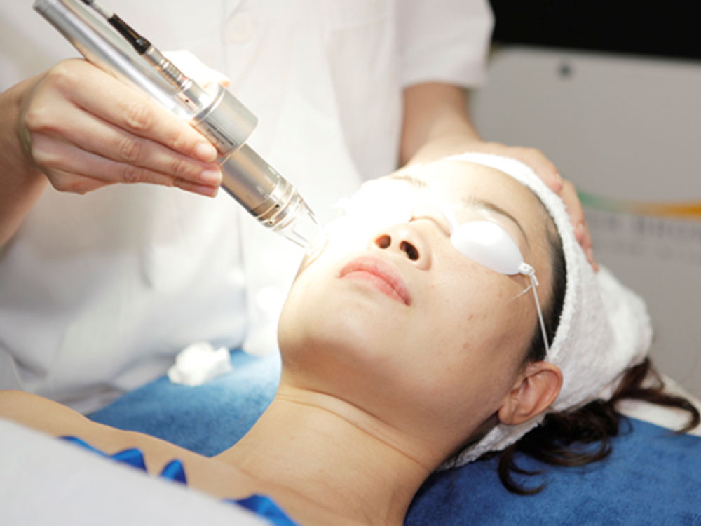 Điều trị tăng sắc tố bằng Laser 