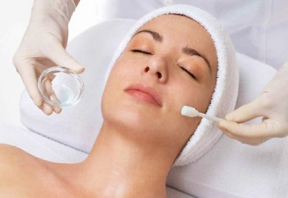 Điều trị tăng sắc tố da bằng Peel hóa học
