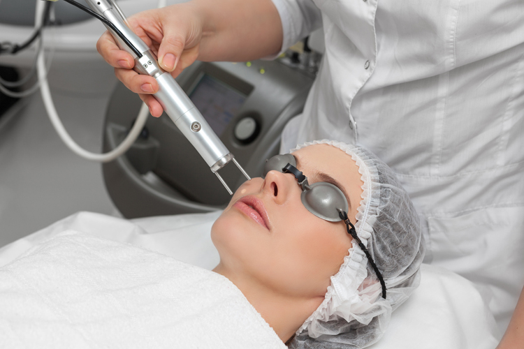Laser treatment for dark spots