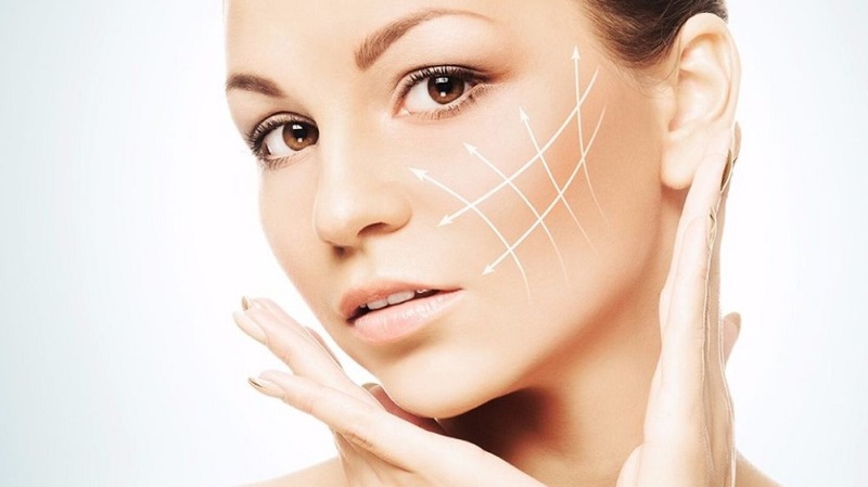 Đối tượng nên căng chỉ nâng rãnh miệng cằm