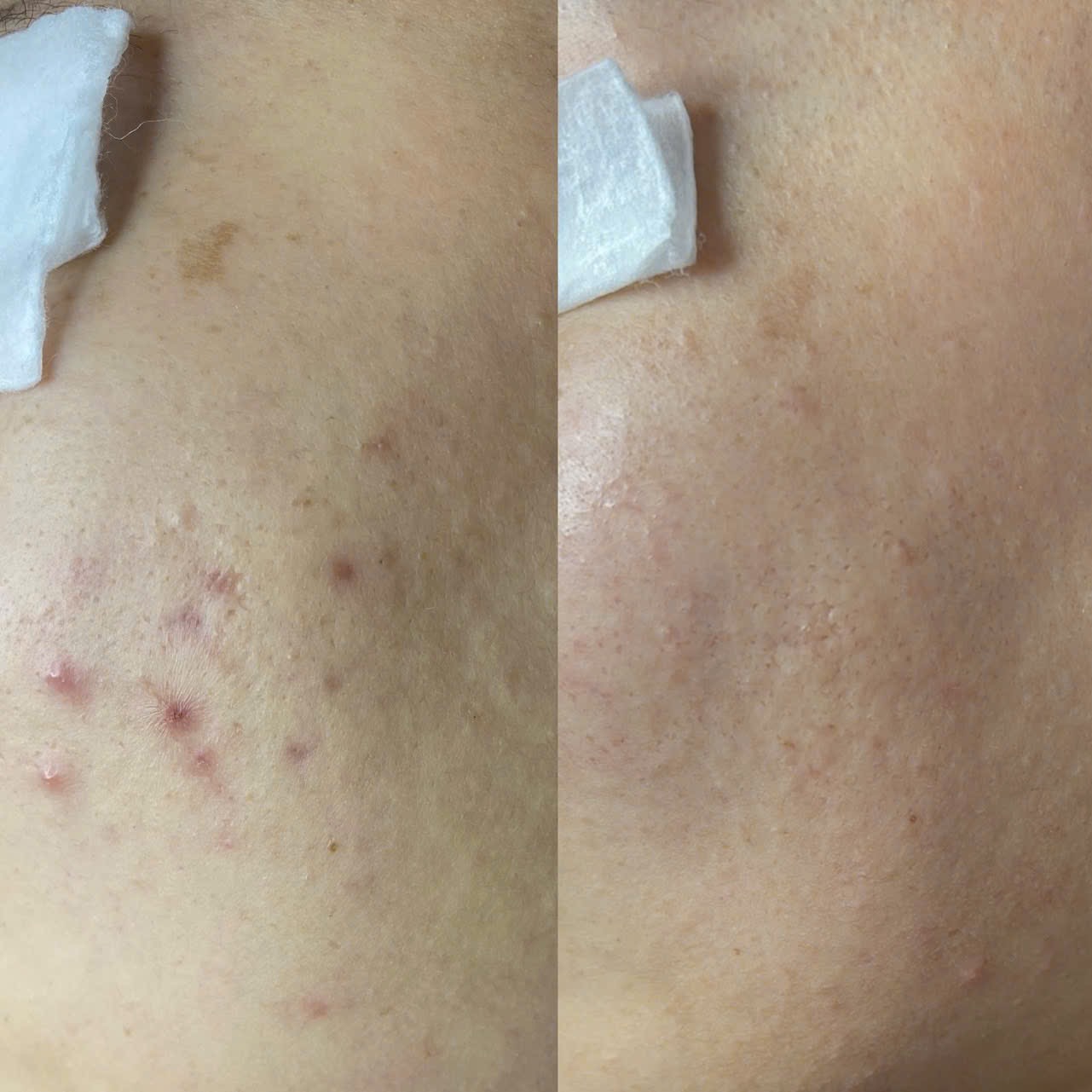 Hướng dẫn chăm sóc sau khi điều trị