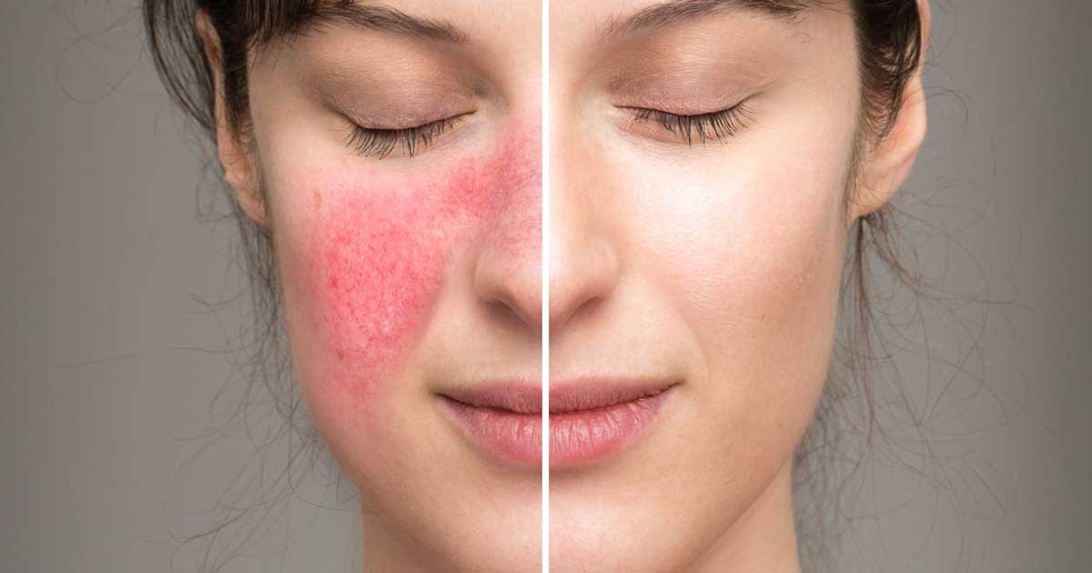 Làm sáng và đồng đều sắc tố da