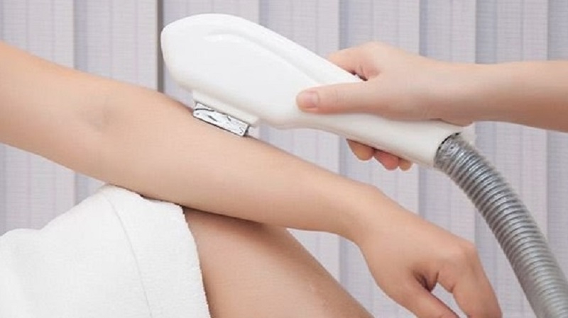 Lợi ích của công nghệ triệt lông laser diode