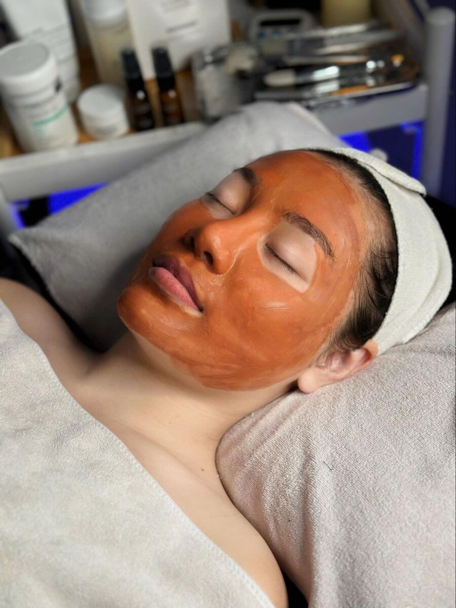 Important notes when caring for Acne-Prone Skin