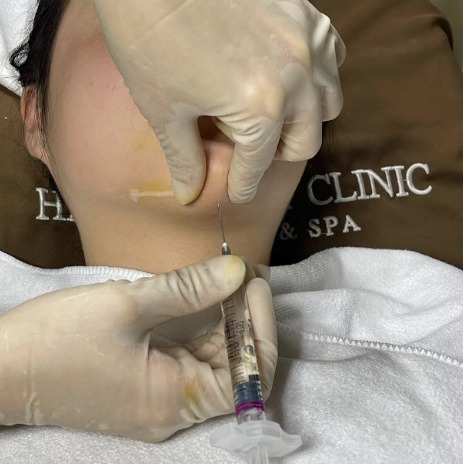 Một số phương khác giúp khuôn mặt thon gọn