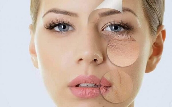 Những nguyên nhân khiến da mặt chảy xệ