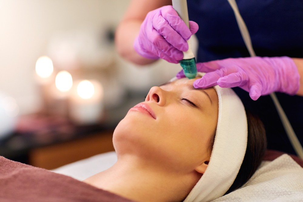 Phương pháp mài da vi điểm trong điều trị tăng sắc tối