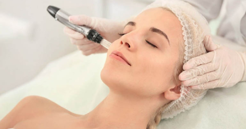Quy trình điều trị bằng công nghệ plasma