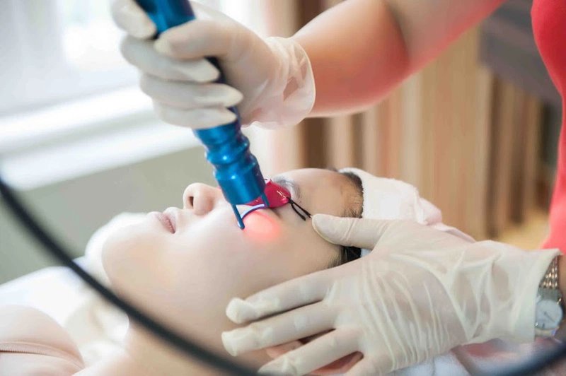Laser skin resurfacing – eliminate wrinkles and uneven pigmentation