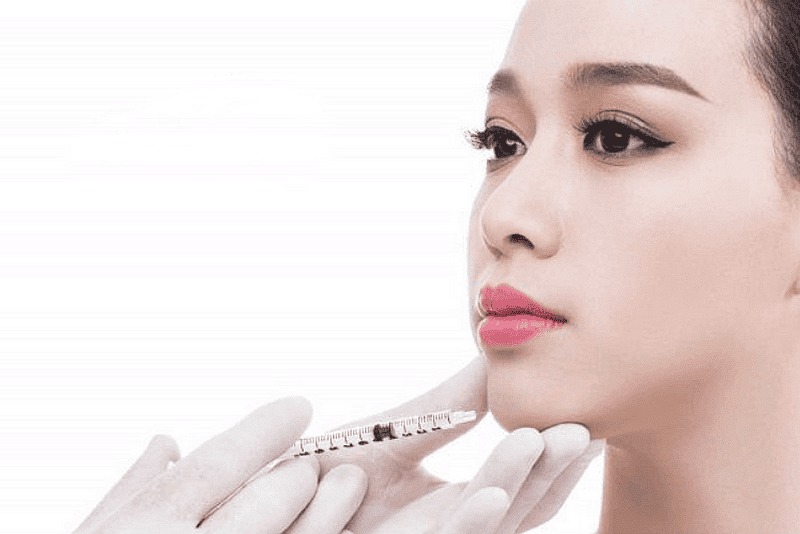 Tiêm filler cằm là gì?