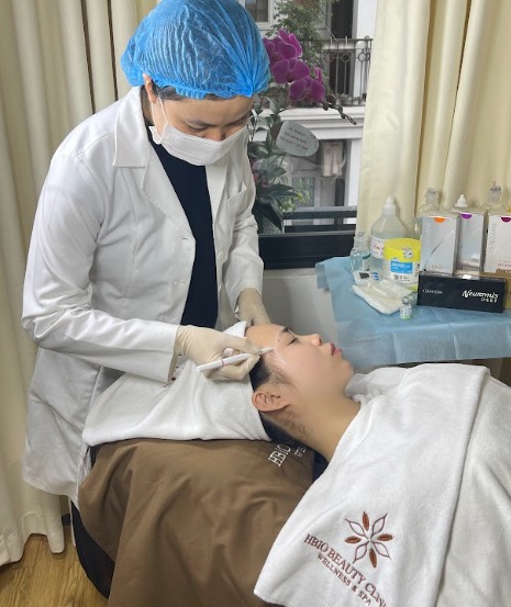 Tiêm filler làm đầy thái dương