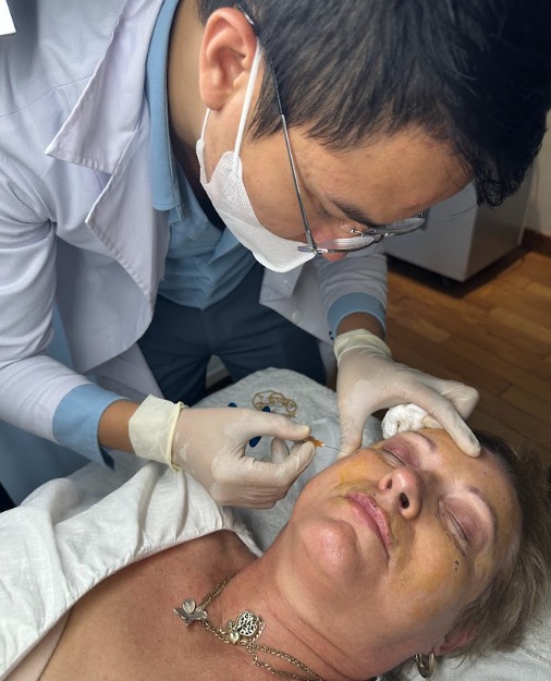 Tiêm filler vùng dưới mắt
