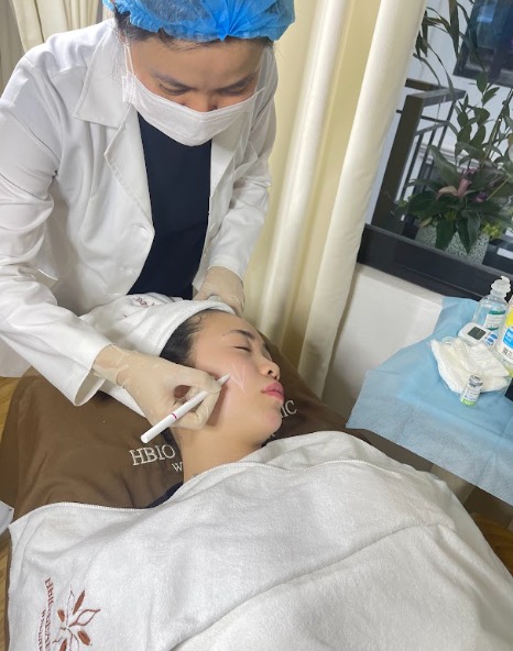 Tiêm Filler