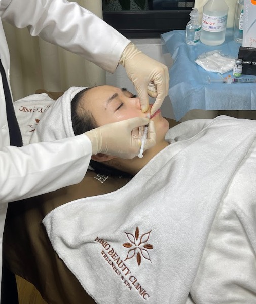 Tiêm Hyaluronidase (chất làm tan filler)