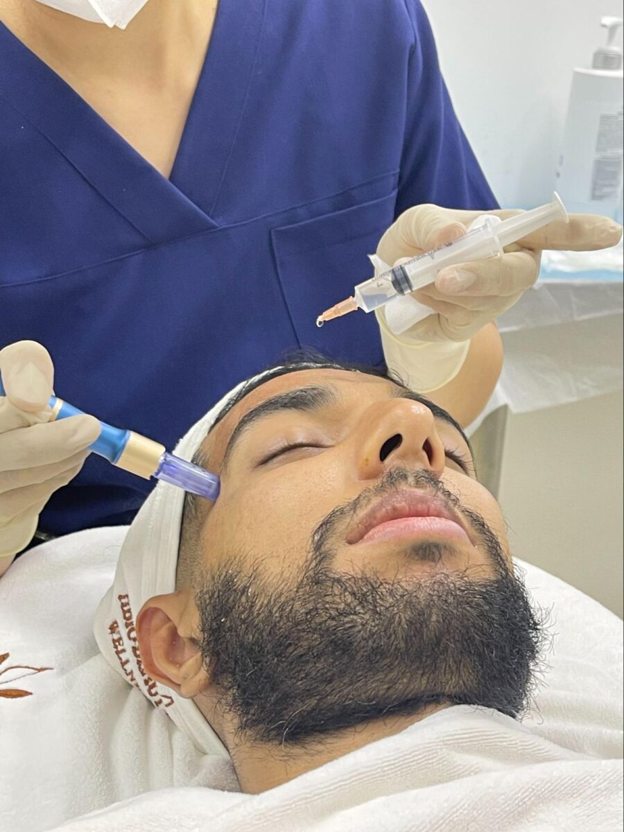 Ứng dụng công nghệ skin pen (microneeding) trong điều trị
