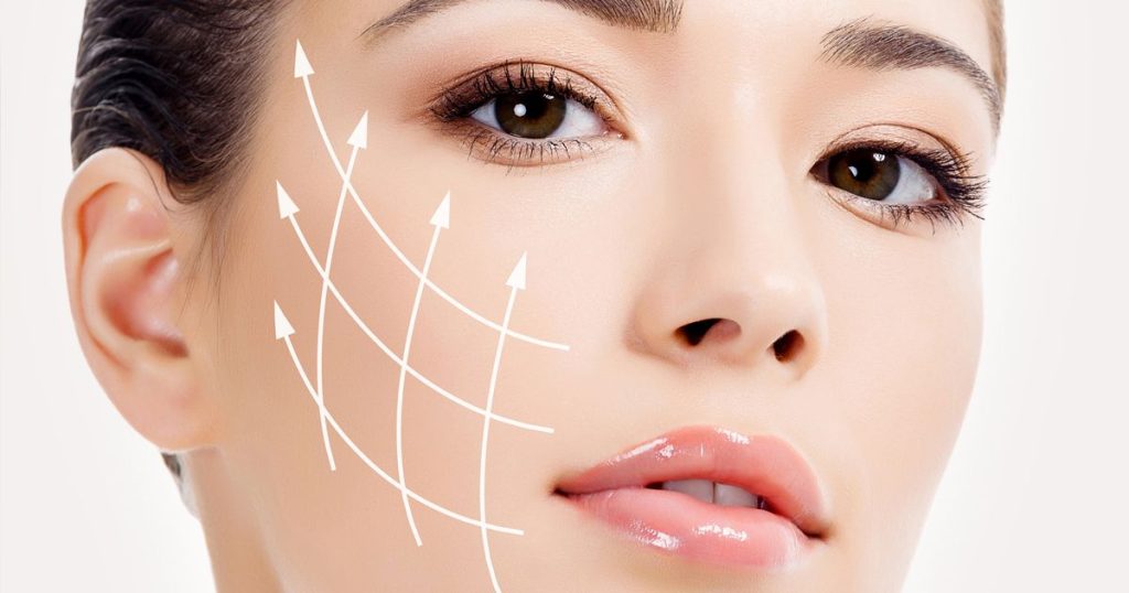 Ưu điểm vượt trội căng chỉ nâng rãnh miệng cằm