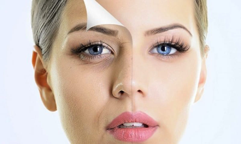 Xóa mờ nếp nhăn và dấu hiệu lão hóa