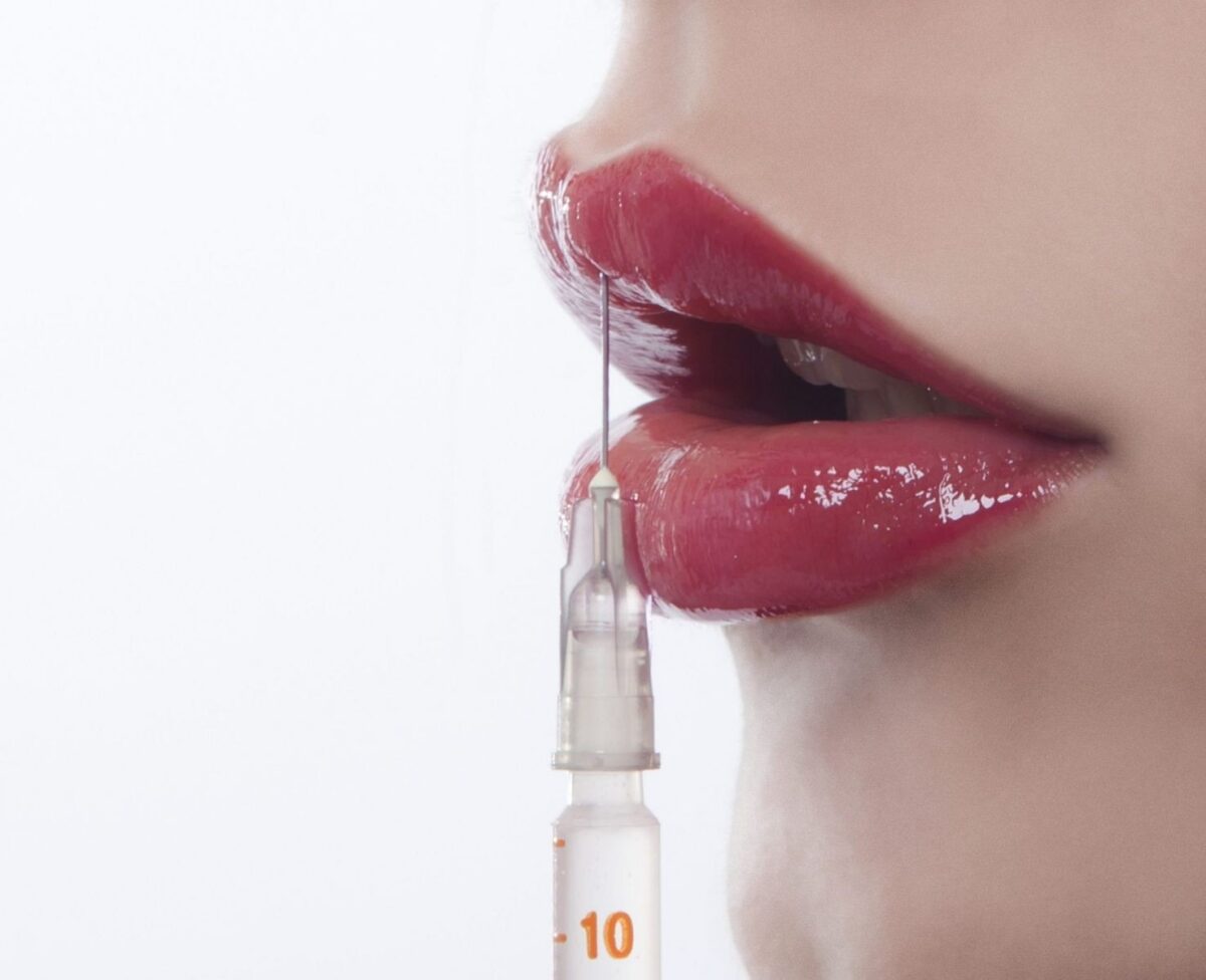 Một số dáng môi phù hợp cho người môi dày muốn tiêm filler
