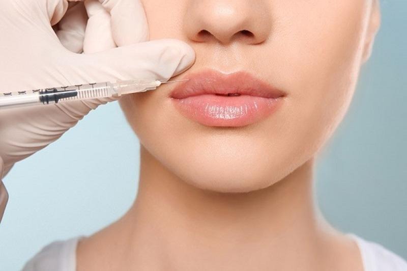 Những lưu ý quan trọng khi tiêm filler và phun môi