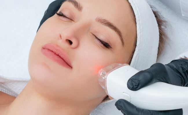 Tái tạo da mặt bằng công nghệ laser