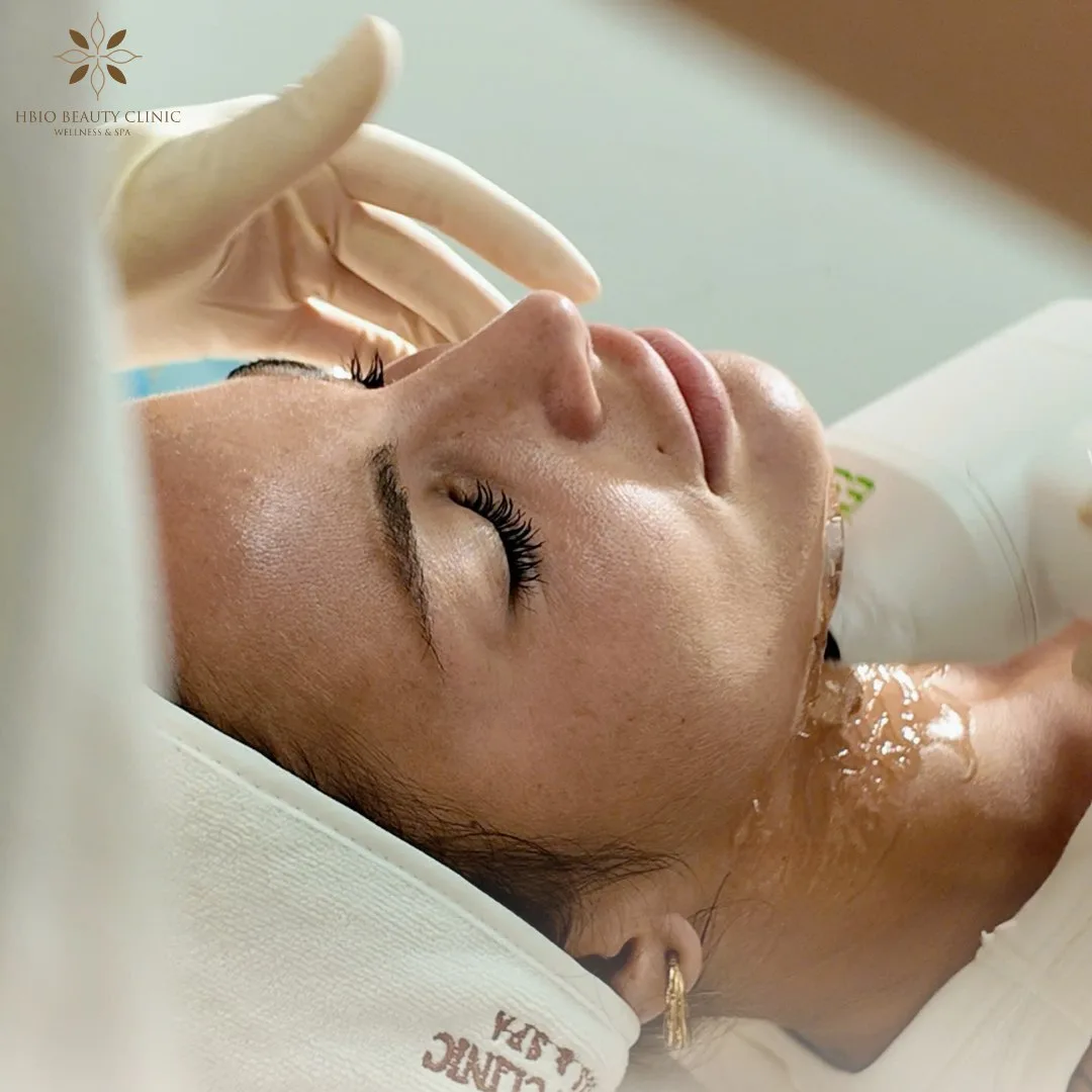 Công nghệ trị nám sau sinh tại HBIO Clinic