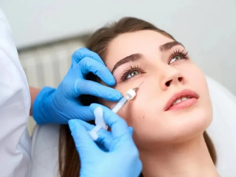 Tiêm Filler trẻ hóa – làm đầy rãnh mắt, cải thiện quầng thâm