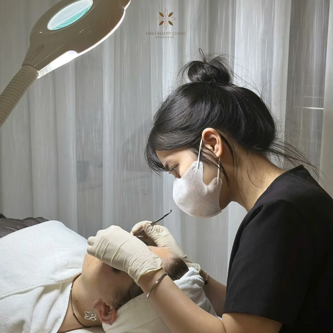 Trẻ hóa làn da với công nghệ Aqua Peel tại Hbio Clinic